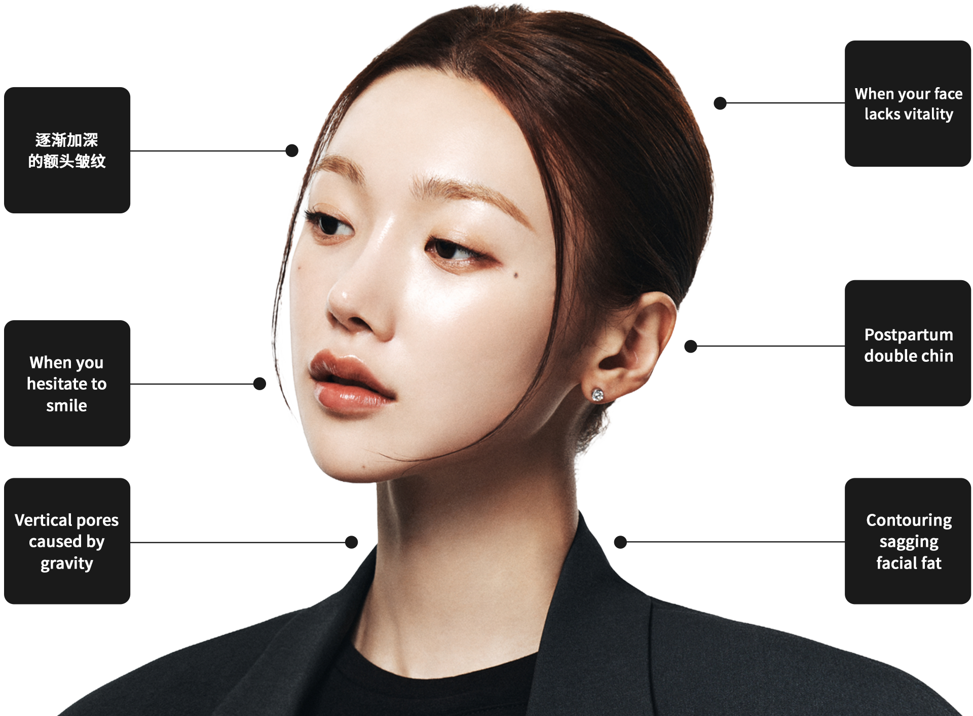 Ultherapy 자가진단 부위 안내